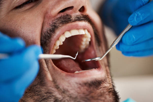Oral Cancer Screening in Upper Montclair, NJ