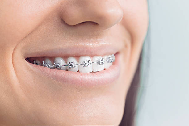 Professional Holistic Dental Care Services in Upper Montclair, NJ